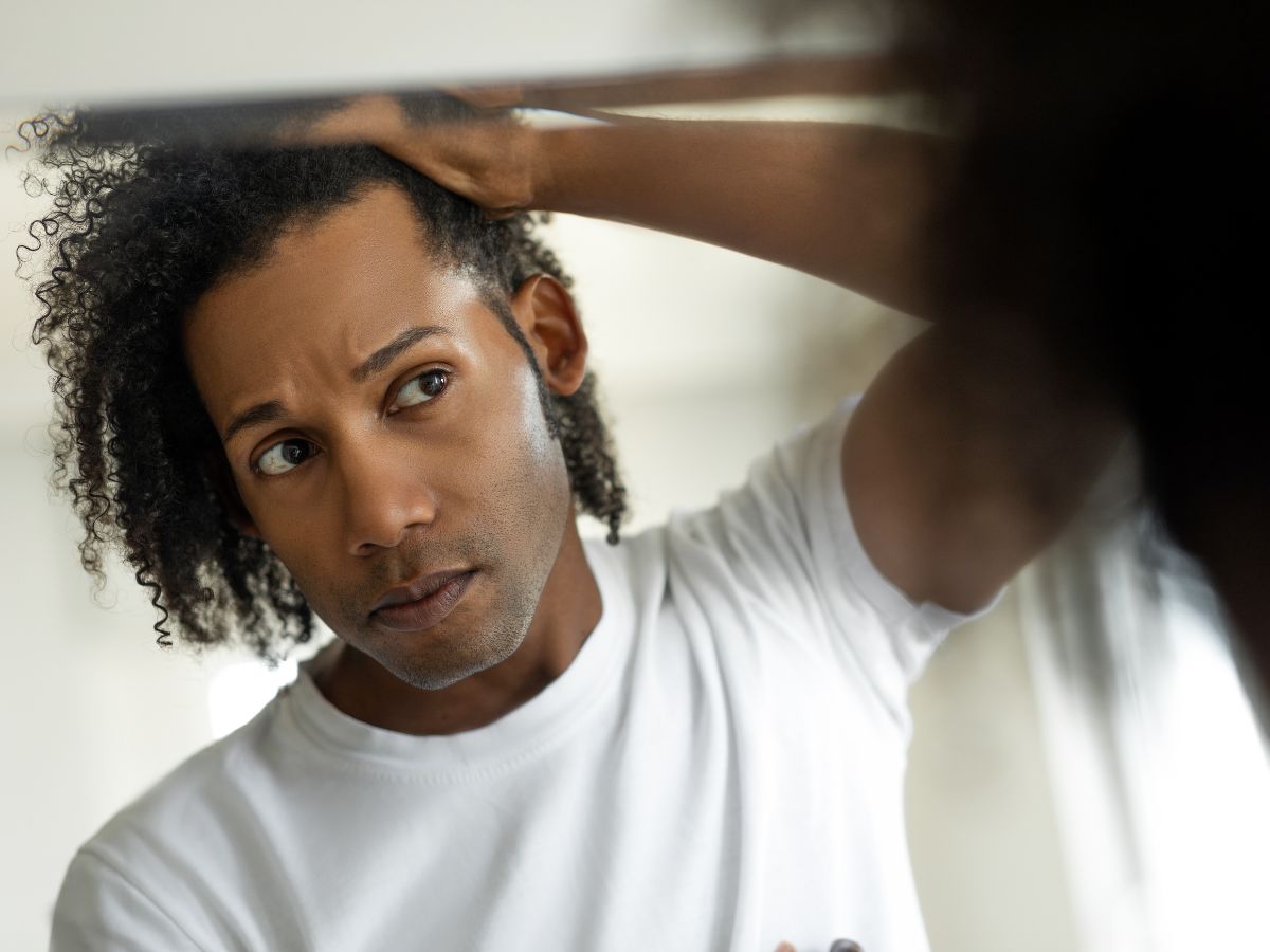 Finasteride or Minoxidil or Both: Choosing the Right one for Hair Loss
