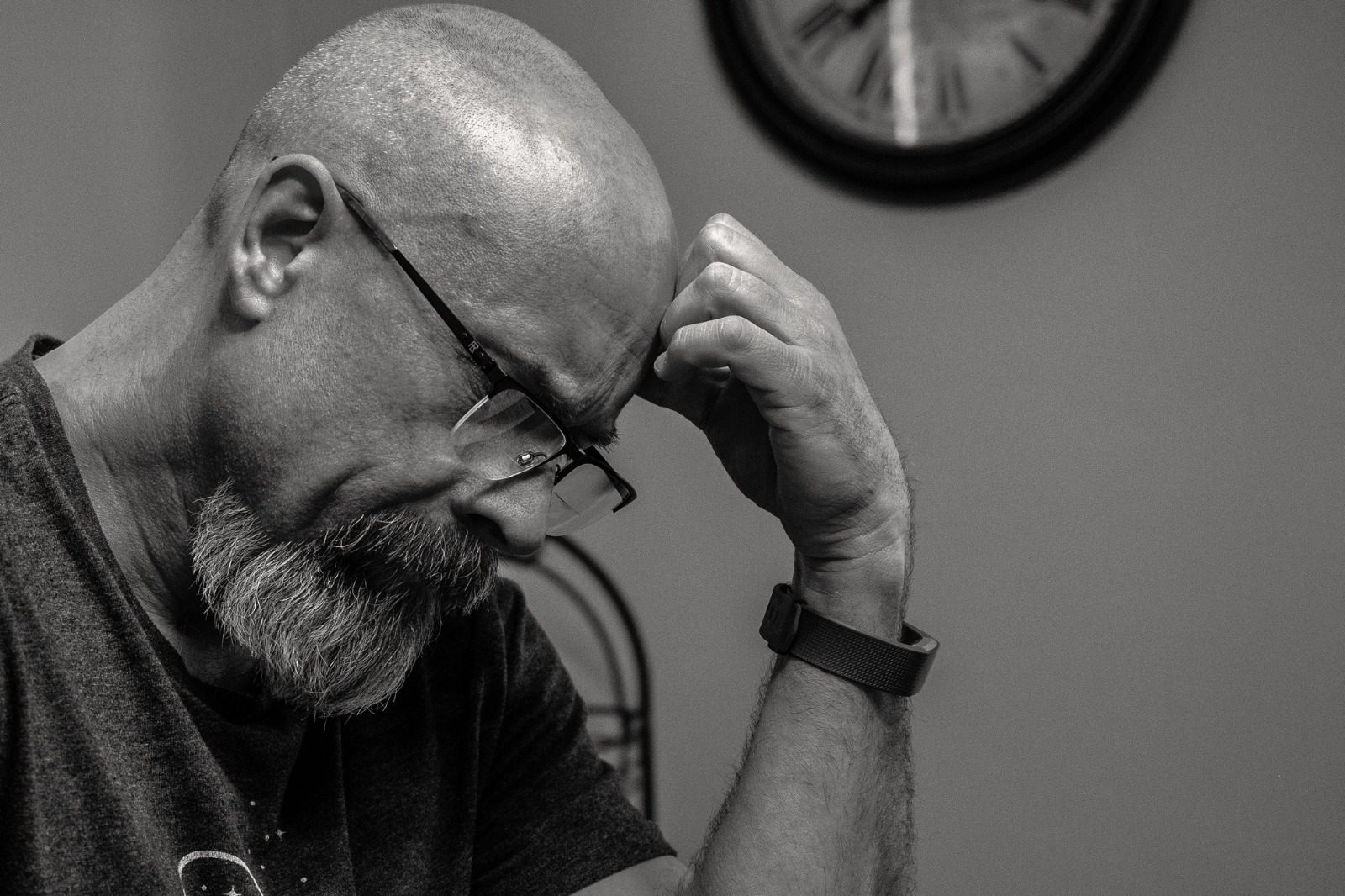 Can Low Testosterone Cause Hair Loss?