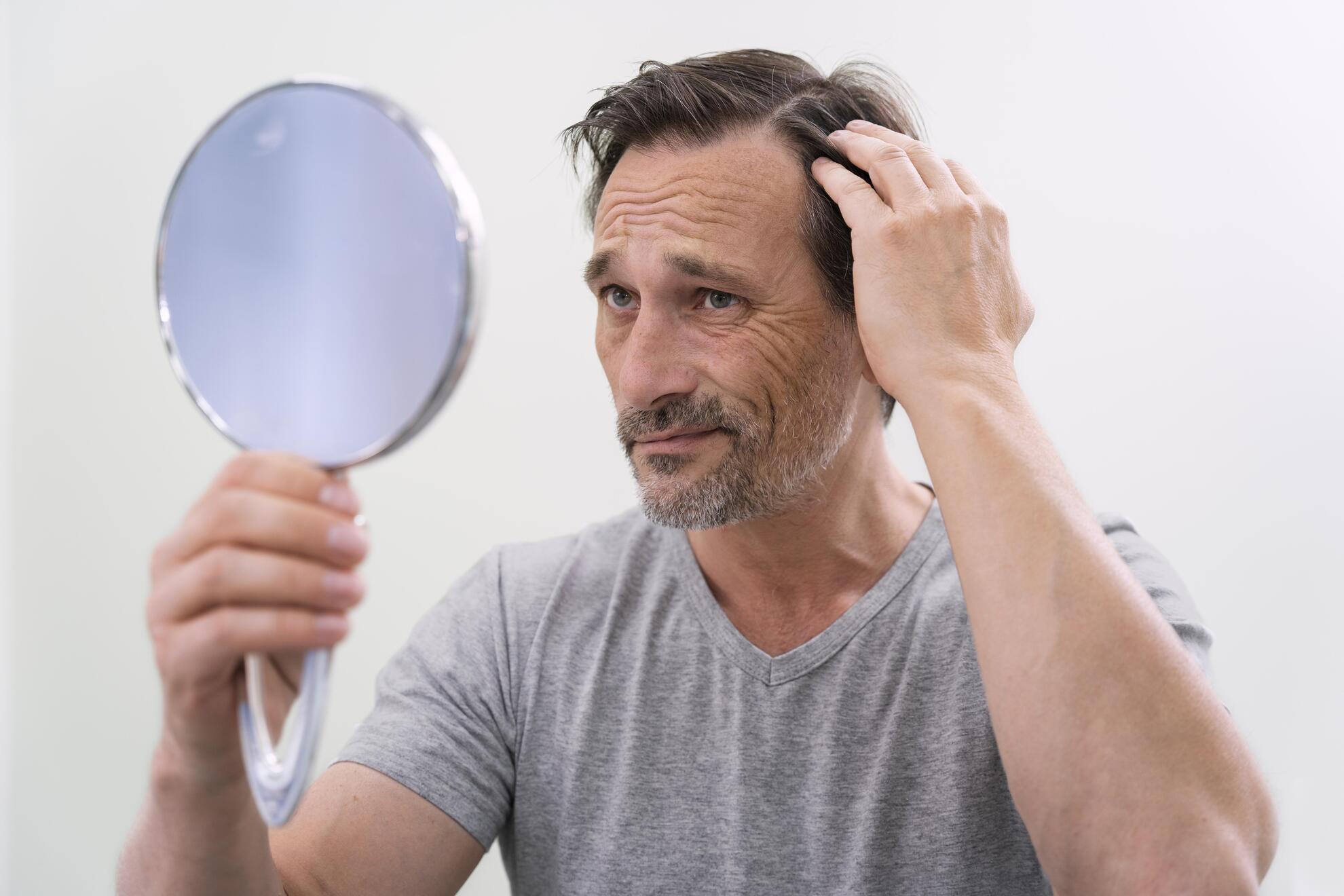Aging and Hair Loss: Why Does It Happen as We Get Older?